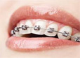 ortodoncja th